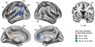 Neural Activity Patterns in the Human Brain Reflect Tactile Stickiness Perception